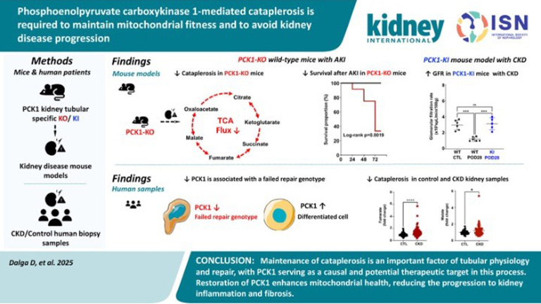 Protecting kidneys from damage: The crucial role of PCK1